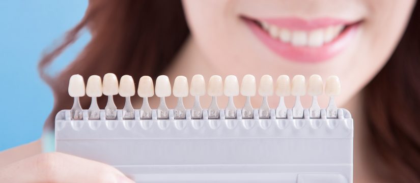 teeth whitening are you an ideal candidate