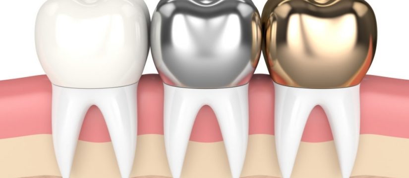 how-to-protect-and-perfect-your-teeth-with-crowns