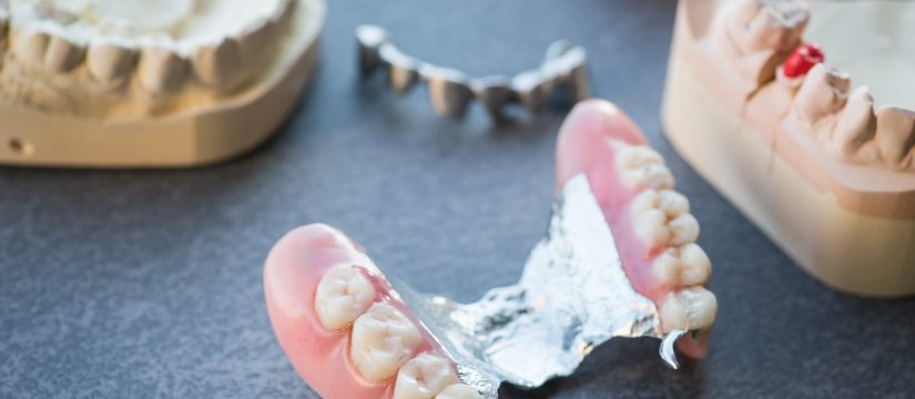 how-often-should-you-get-your-dentures-relined
