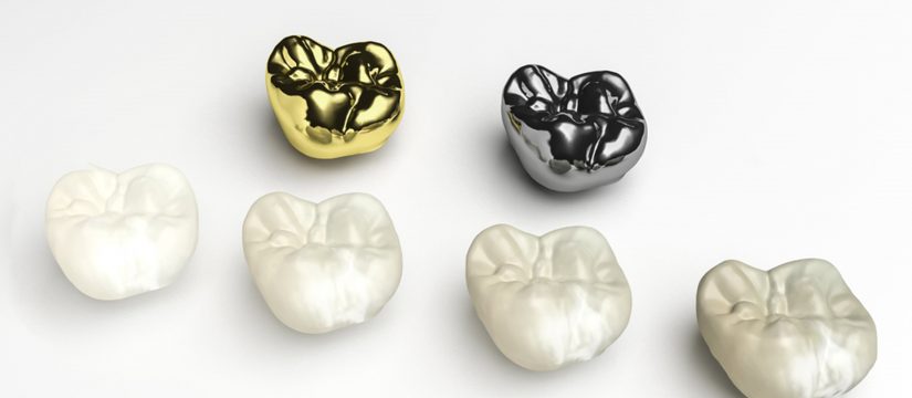 what happens when you lose a dental crown