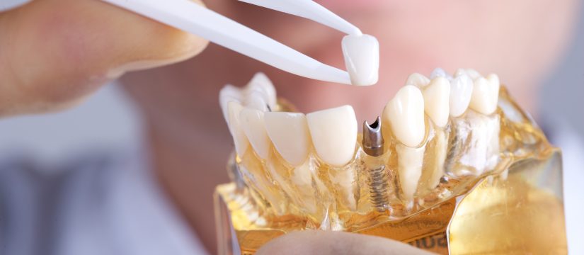 what should i do if i have an infected dental implant
