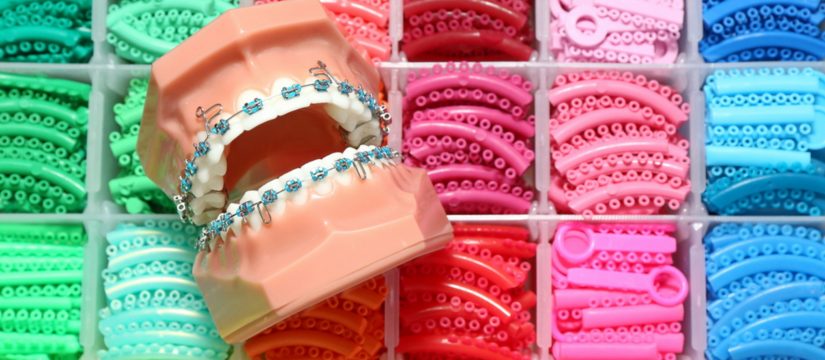 orthodontic treatment overview