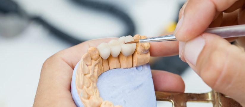 the complete guide to dental bridge treatment procedure and post care tips